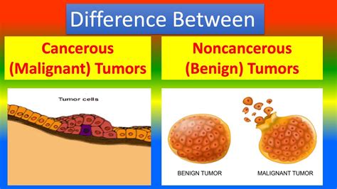 Difference Between Cancerous Tumors And Noncancerous Tumors Youtube