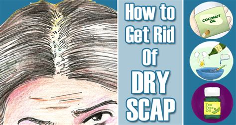 Hair care experts show that overnight hair masks may help tame frizz, infuse hair shafts with moisture, reduce hair breakage, add a glossy shine to the hair, and decrease. How to Get Rid of Dry Scalp Overnight with Home Remedies ...