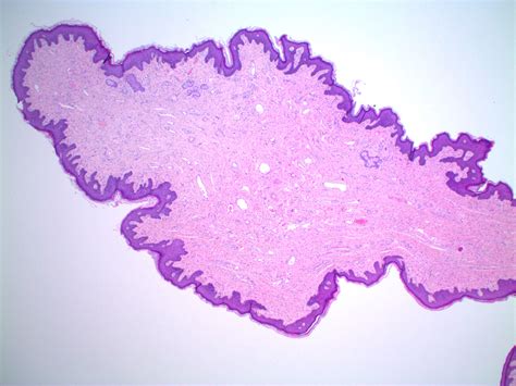Pathology Outlines Histology