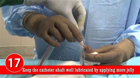 Male Urethral Catheterization Youtube