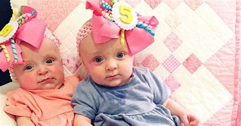 Twins Survive Twin To Twin Transfusion Syndrome And Reunite
