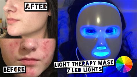Testing Led Light Therapy Mask For Acne Project E Beauty Led