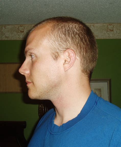 Blonde Receding Hairline