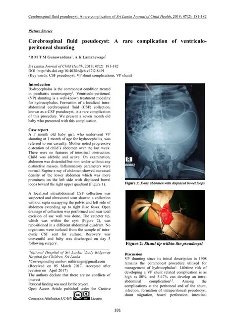 Pdf Cerebrospinal Fluid Pseudocyst A Rare Complication Of Ventriculo Peritoneal Shunting