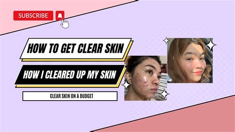 How To Get Clear Skin How I Cleared Up My Skin Youtube