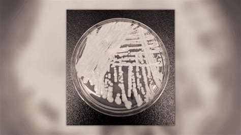 Deadly Fungus Spreading At An Alarming Rate Across Us Cdc Wpde