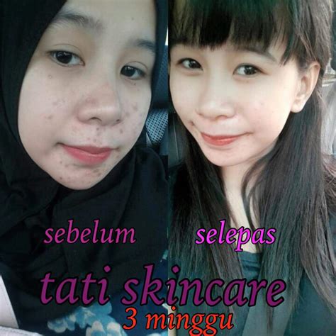 Bluebell skincare adalah produk halal dan dijual diconstant pharmacy. Nayli Suhaili Collections: Tati Skincare 5 in 1 Murah Dan ...