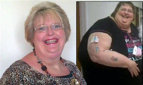 A Women Who Was So Overweight That She Fell Into A Coma Twice Is Now