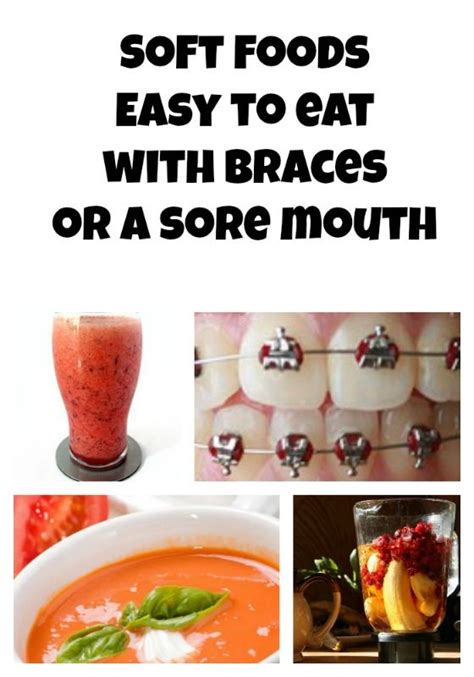 Why are some foods not ok to eat? Got braces? Here are some easy to eat foods for those ...