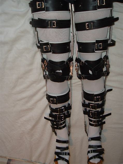 Picture Of Braces And Sandals Securely Buckled In Place Flickr