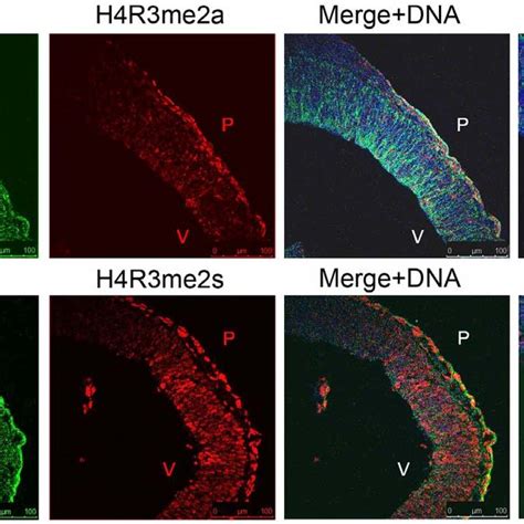 H4r3me2s But Not H4r3me2a Are Found In The Early Neural Precursors At