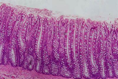 Simple Columnar Epithelium Under Microscope