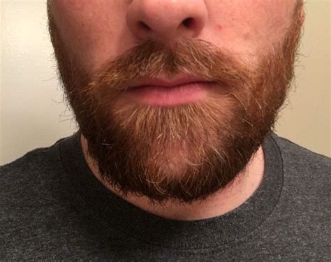 How To Fill In A Patchy Beard Justinboey