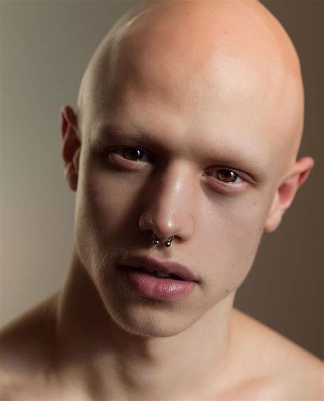 pin by aɴᴅʀᴇᴀs pᴏʜʟ on aʟᴏᴘᴇᴄɪᴀ bald head man shave eyebrows balding