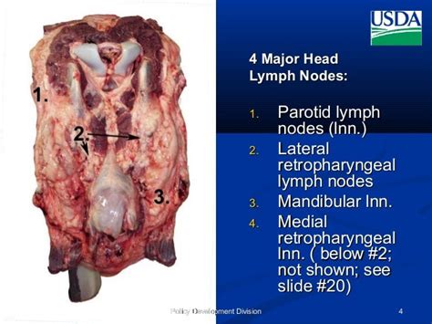 Head Anatomyand Lymph Nodes
