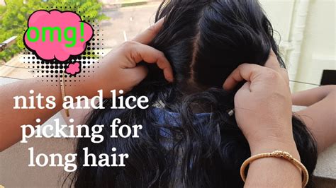 Hair Lice Nit Picking For Long Hair Nits Lice Picking With Hands
