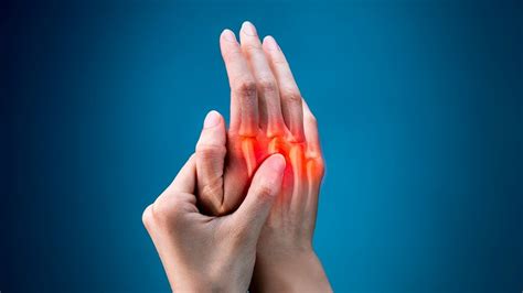 The 4 Stages Of Rheumatoid Arthritis And Its Symptoms Gethow