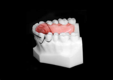 Hawley Retainer With Flat Bow Upper Universal Orthodontic Lab