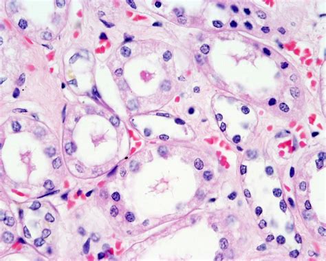 Renal Pyramid Histology