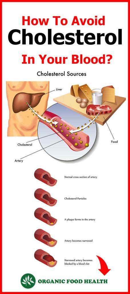 From there it's either broken down or passed out of the body as a waste there's also an inherited condition called familial hypercholesterolaemia. High Cholesterol Dinner Ideas - Cholesterol Symptoms - #HighCholesterolRemedies - High ...