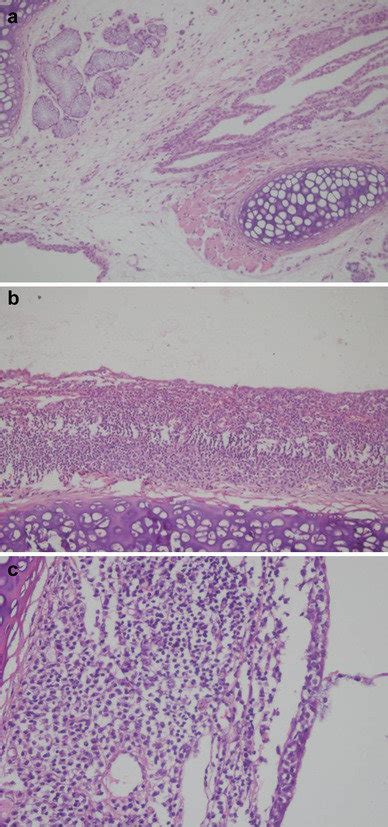 Histopathological Appearance Of Larynx Tissue In Irradiation Ir A