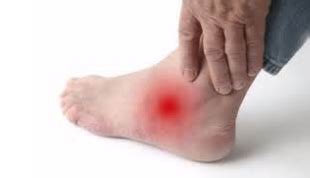 Foot problems caused by psoriatic arthritis sure can be tricky to pronounce. Crown Foot and Ankle Baseball Injuries to the Foot & Ankle