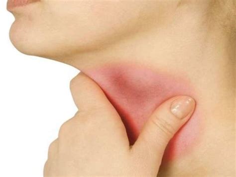 Itchy Throat Causes Treatment Symptoms