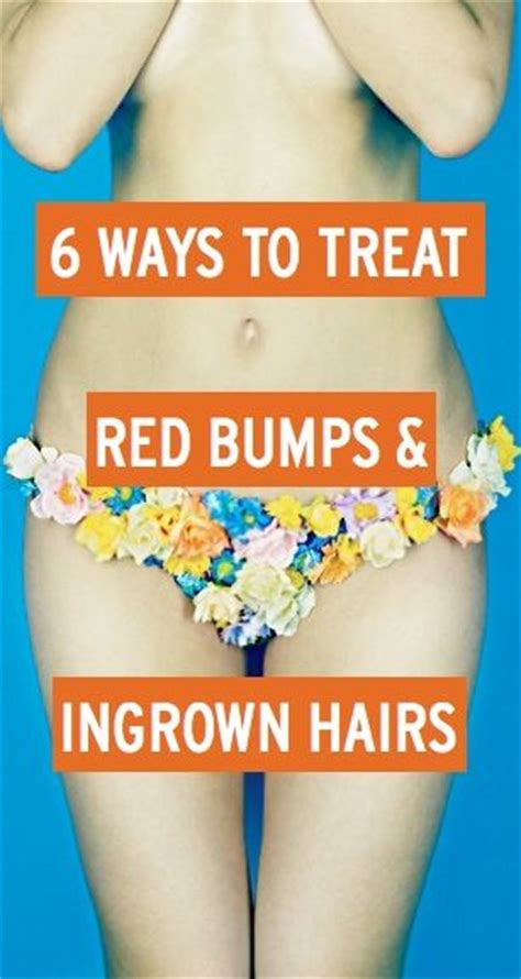 We Heart It 6 Ways To Treat Red Bumps And Ingrown Hairs From Shaving Or Waxing