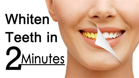 Teeth Whitening At Home In 2 Minutes How To Whiten Your Yellow Teeth