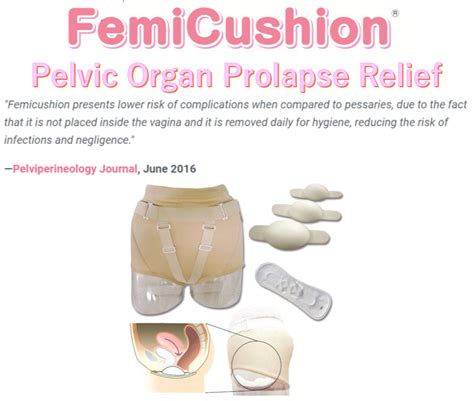 Relieve Pelvic Organ Prolapse Symptoms With Femicushion