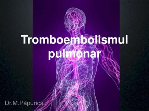 Tromboembolismul Pulmonar Atimures Roatimures Ro Wp Content Uploads