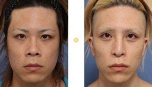 Search the world's information, including webpages, images, videos and more. ローランド(ホスト)年収や整形前画像や名言集!wiki ...