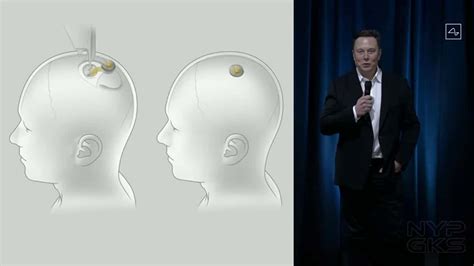 Neuralink Brain Implant Prototype Demoed By Founder Elon Musk Noypigeeks