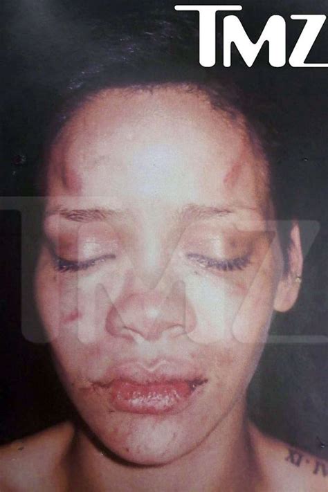 Judge Examines Lapd Officer Tied To Leak Of Rihanna Beat Up Photo