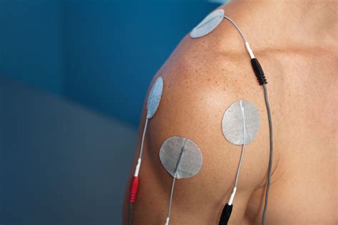 Will Electrical Stimulation Help Me Recover From Stroke