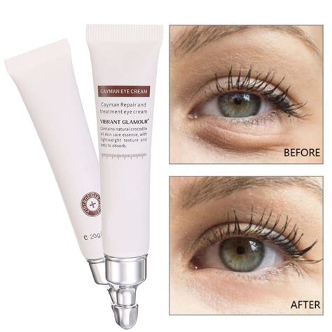 Eye Serum For Dark Circles Puffiness Under Eye Reduce Fine Sale