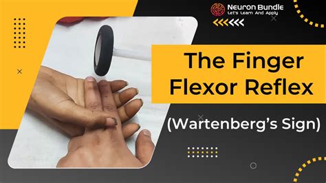 Wartenbergs Sign Finger Flexor Reflex Babinski Upper Limb Reflex