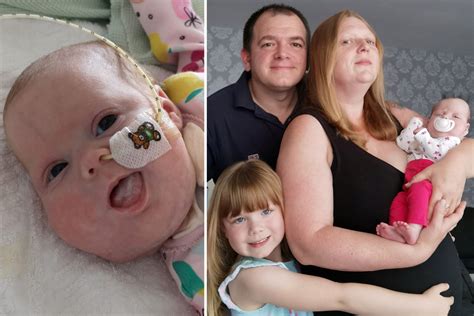 Baby With A Huge Neck Tumour Operated On By Surgeons As She Was Being