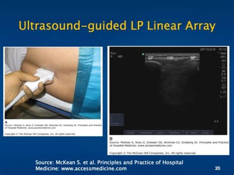 Lumbar Puncture Course Hospital Procedures Consultants