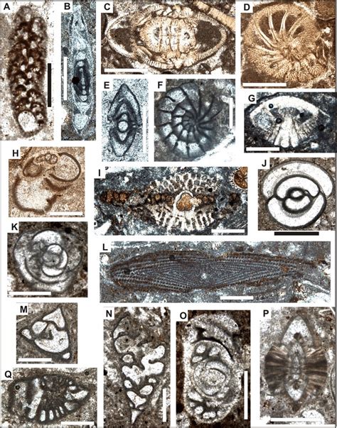 Benthic Foraminifera That May Co Occur With Gyroconulina Columellifera