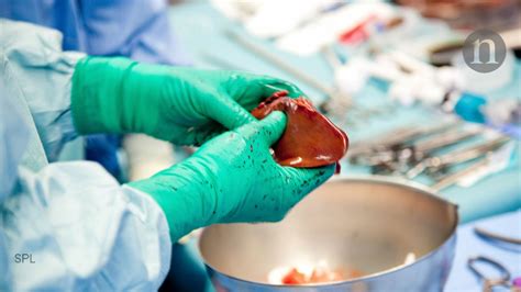 ‘warm Transplants Save Livers And Lives