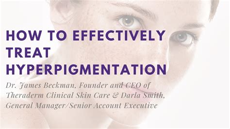 How To Effectively Treat Hyperpigmentation Youtube