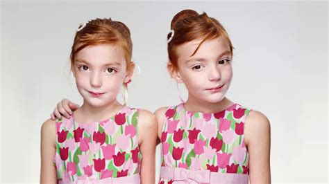 Girl Has A Rare ‘birthmark After Absorbing Her Own Twin Youtube