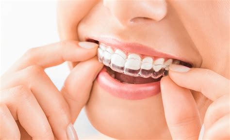 Kosmetisk Tannbehandling Tannlege Oslo Majorstua