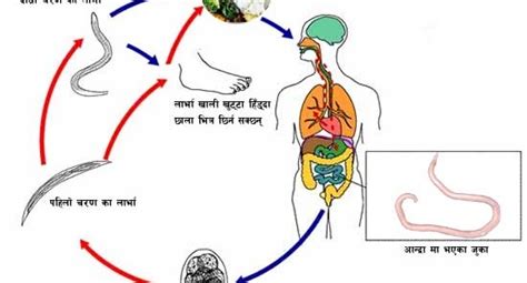 Ascariasis Welcome To Nirogi Nepal Welcome To Nirogi Nepal