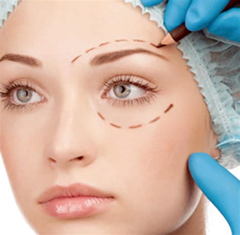 Upper Eyelid Surgery Recovery Cheaper Than Retail Price Buy Clothing Accessories And Lifestyle