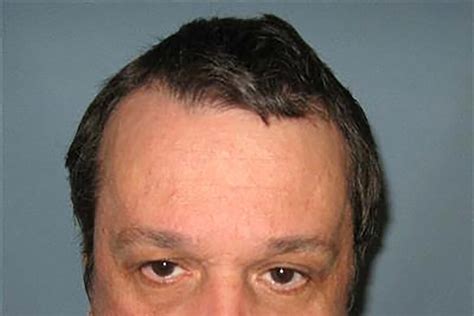 Alabama Death Row Inmate Who Sought New Trial Dies Of Cancer