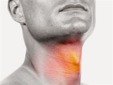Recognize The Symptoms Of Throat Cancer Diseases And Viruses