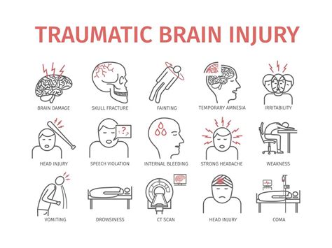 What Type Of Tbi Is The Most Severe Bressman Law