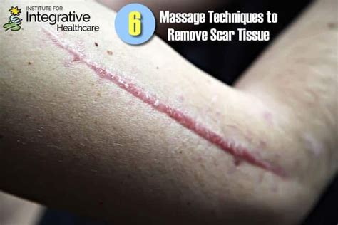 Six Ways To Remove Scar Tissue With Massage Scar Tissue Scar Tissue Massage Scar Massage